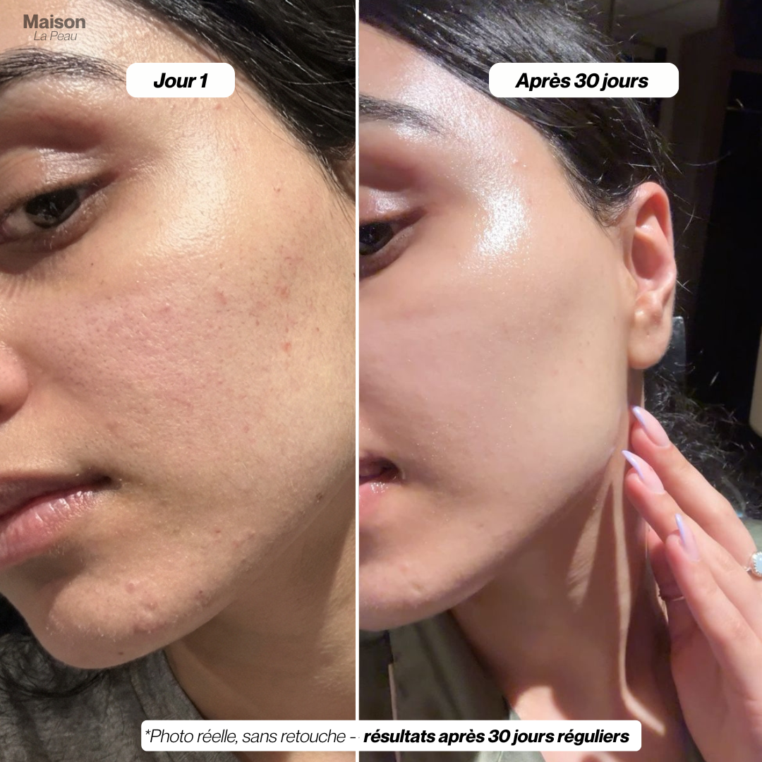 Essence Exfoliante au Riz Noir & Blanc