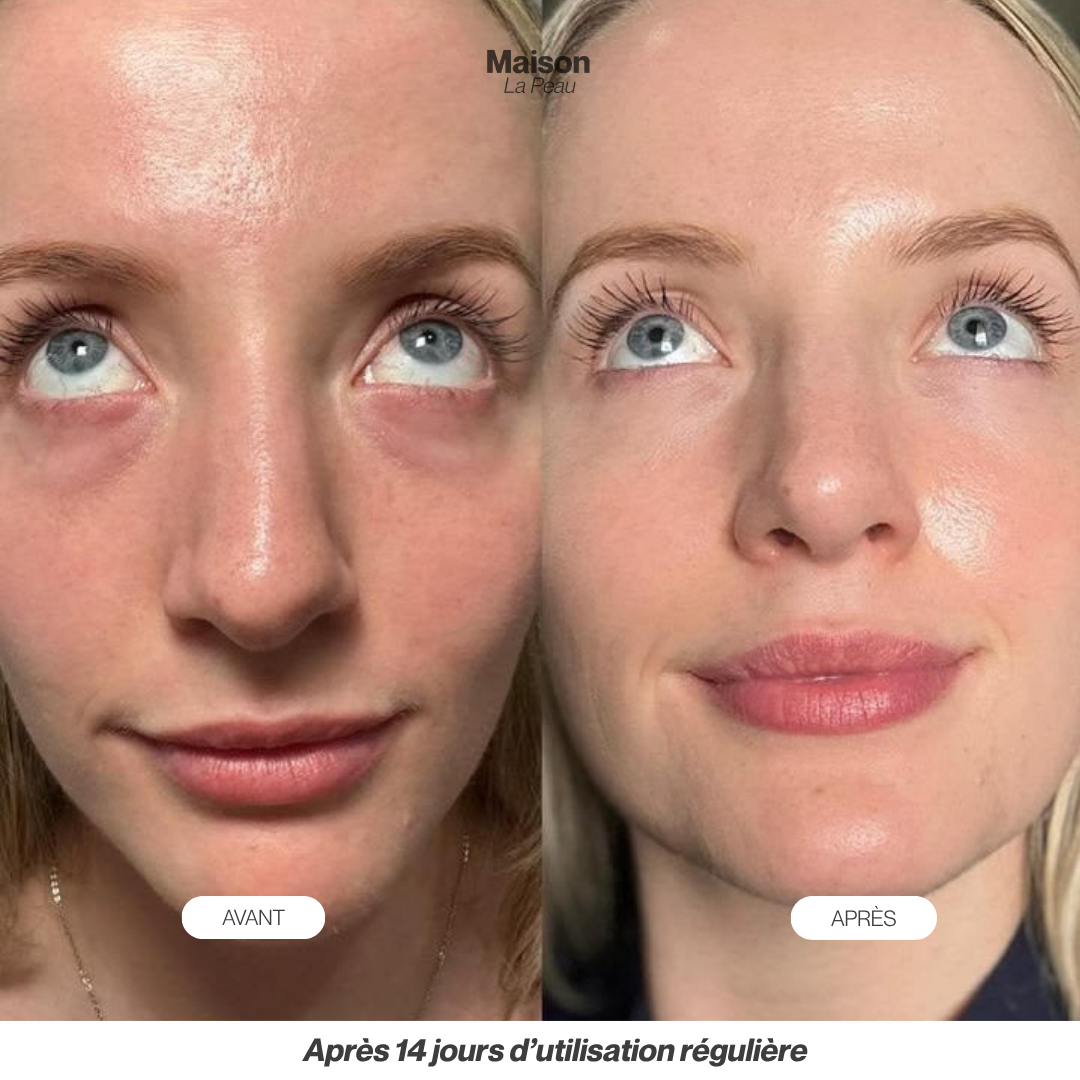 PATCHS HYDROGEL PDRN ANTI-CERNES