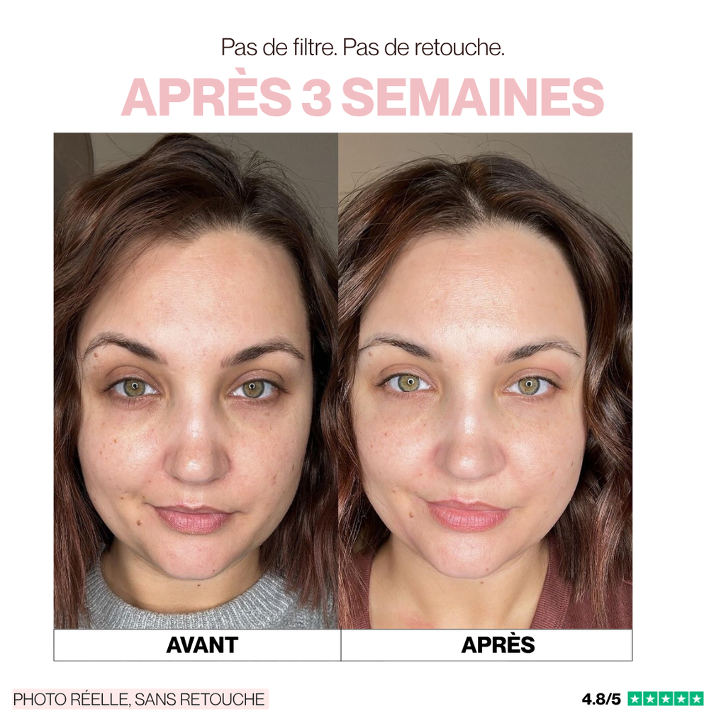 PATCHS HYDROGEL PDRN ANTI-CERNES