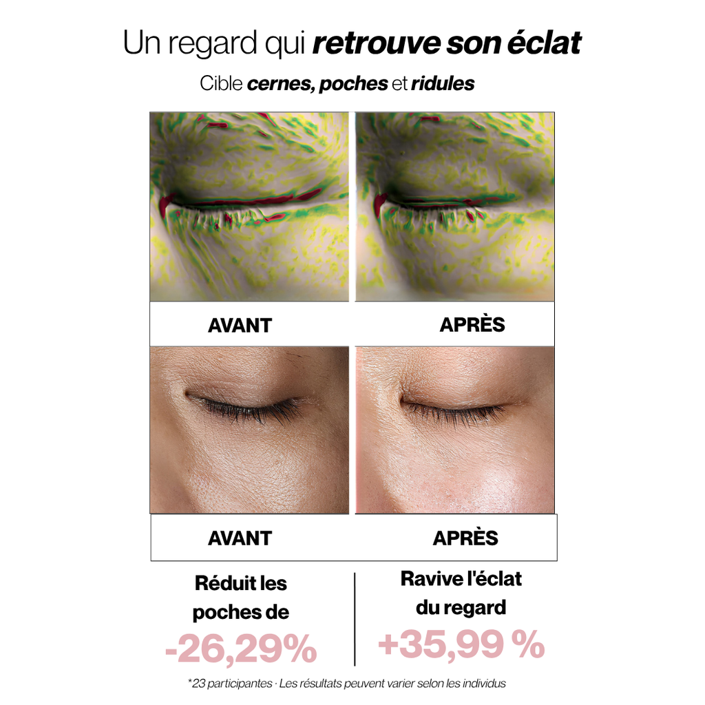 PATCHS HYDROGEL PDRN ANTI-CERNES