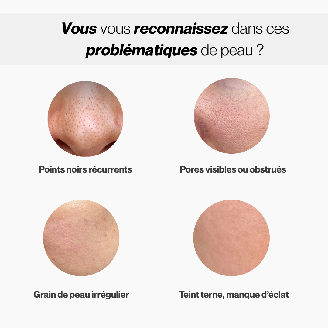 Essence Exfoliante au Riz Noir & Blanc