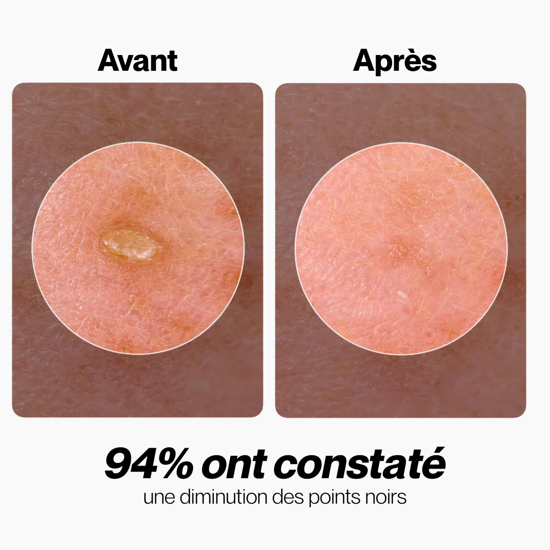 Essence Exfoliante au Riz Noir & Blanc