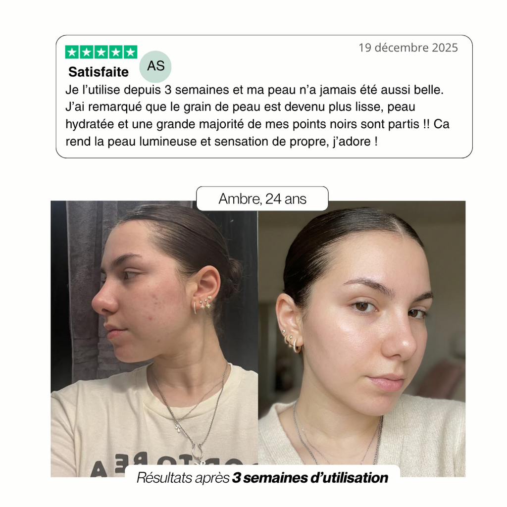 Essence Exfoliante au Riz Noir & Blanc