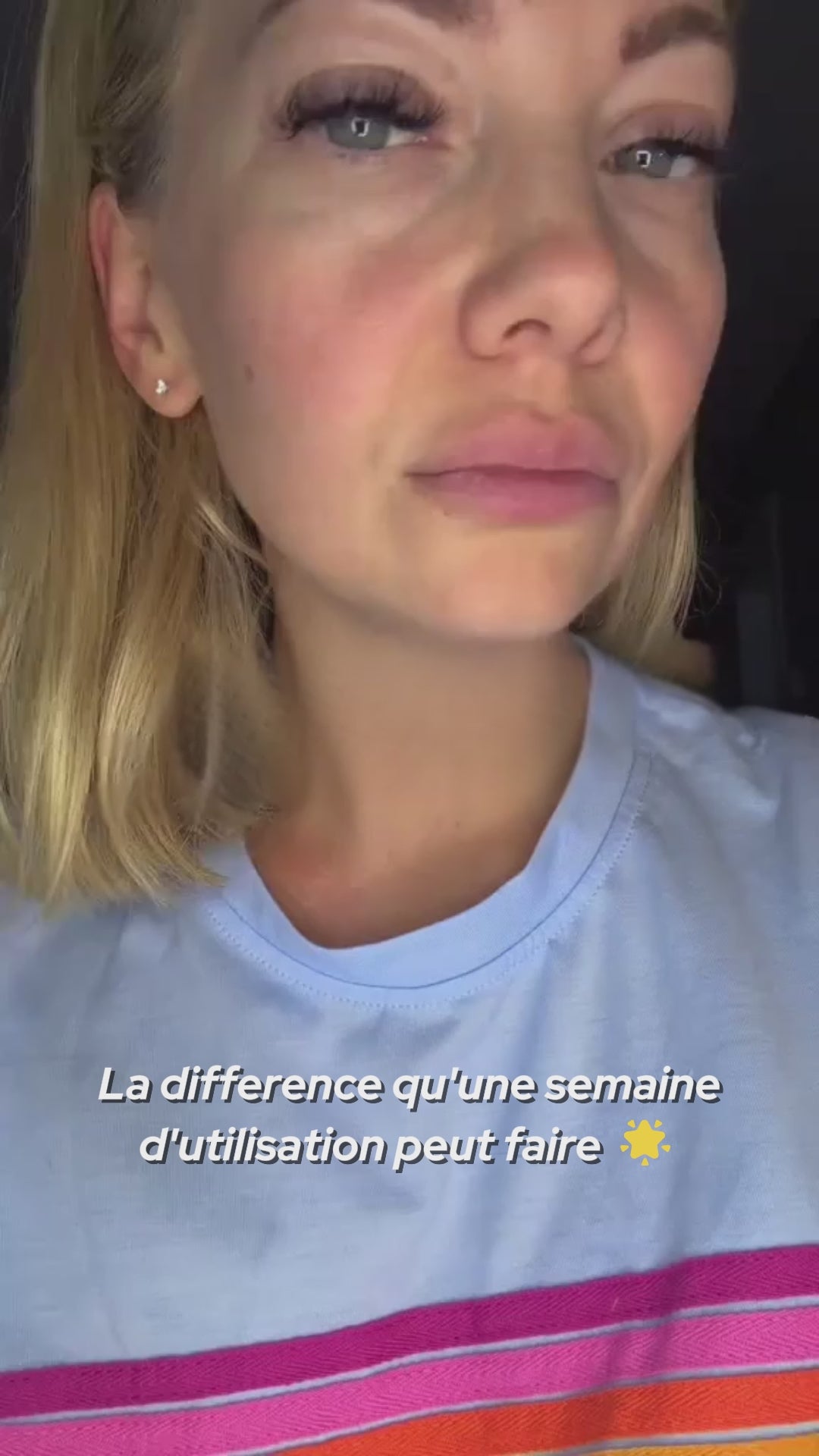 Vidéo